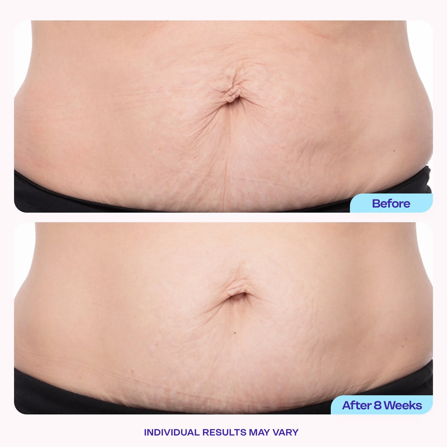 Sculpta Belly Firming Cream — before and after