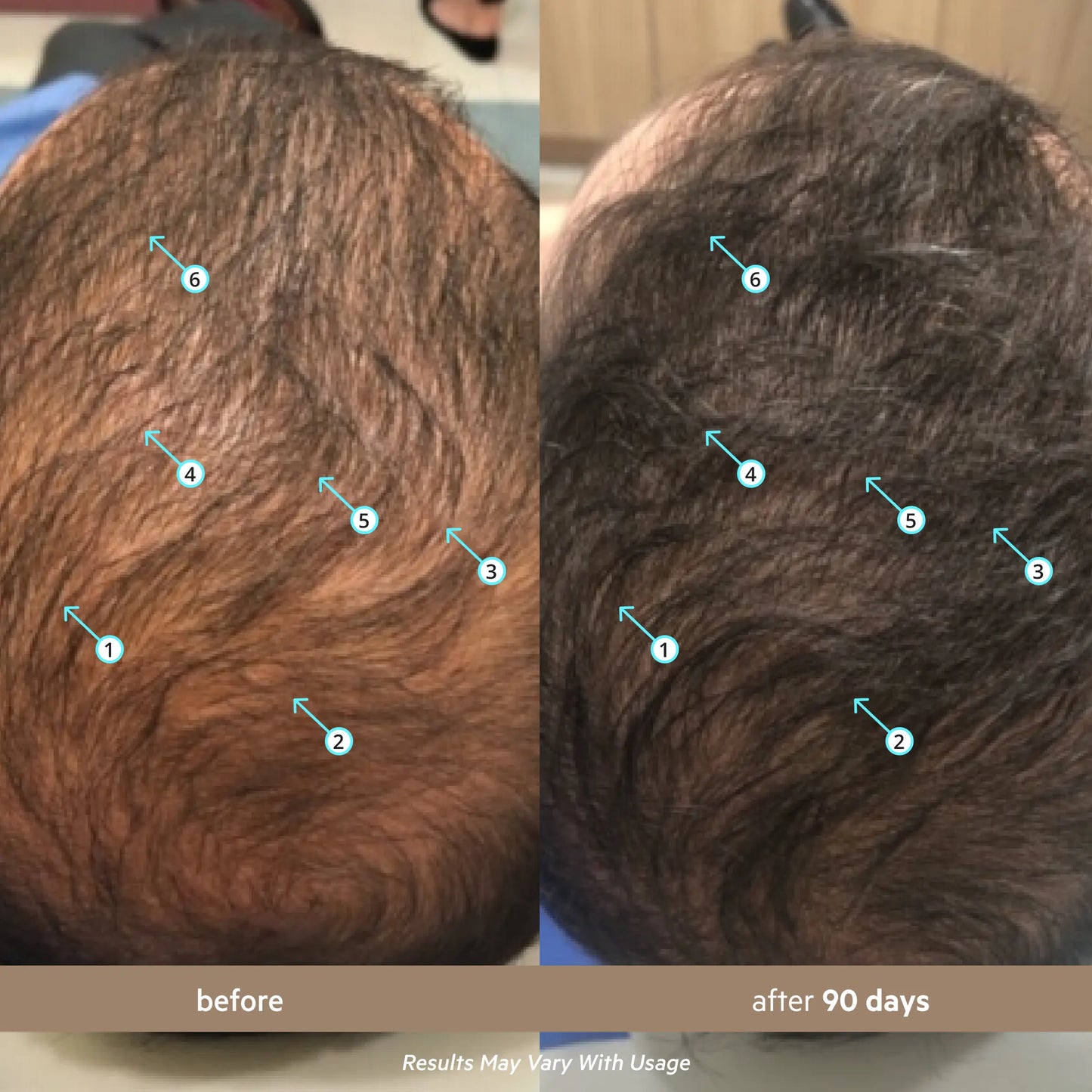 Before and after 90 days crown