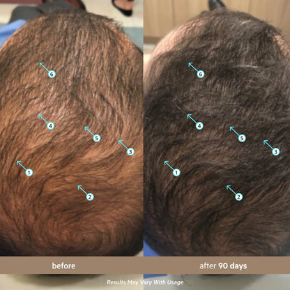 Before and after 90 days crown