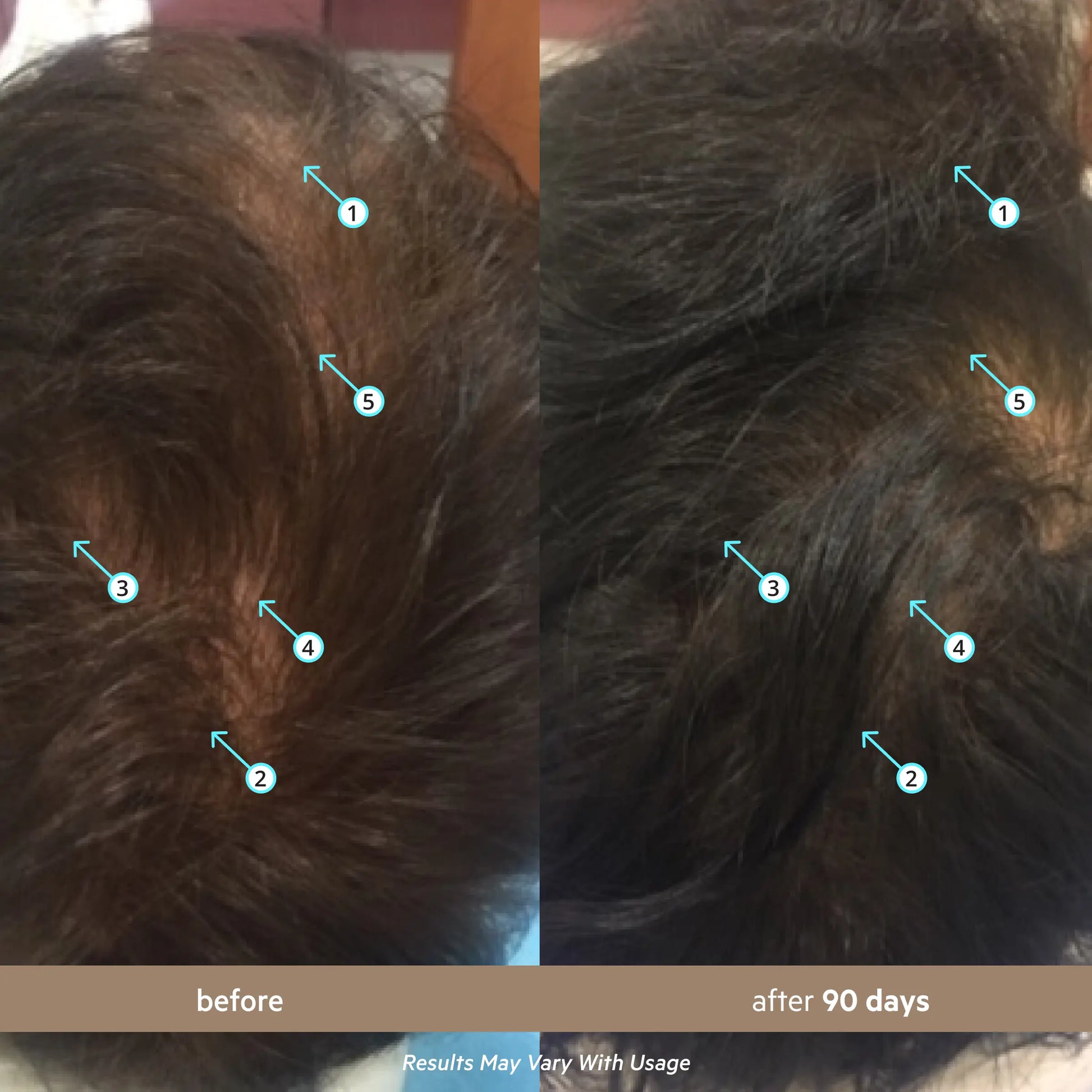 Before and after 90 days
